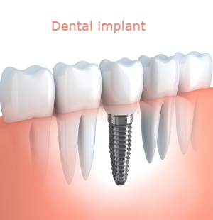bharti dental clinic